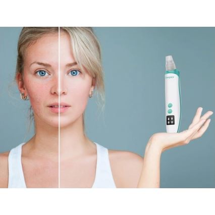 Beper - Uzlādējams poru tīrītājs USB/5V 400 mAh